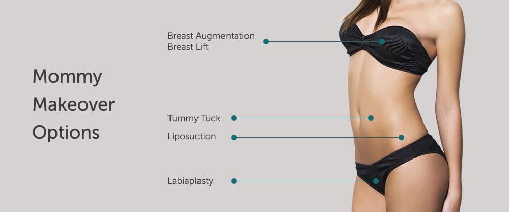 image-mommy-makeover-graphic Mommy Makeover