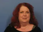 Facelift - Case 389 - Before