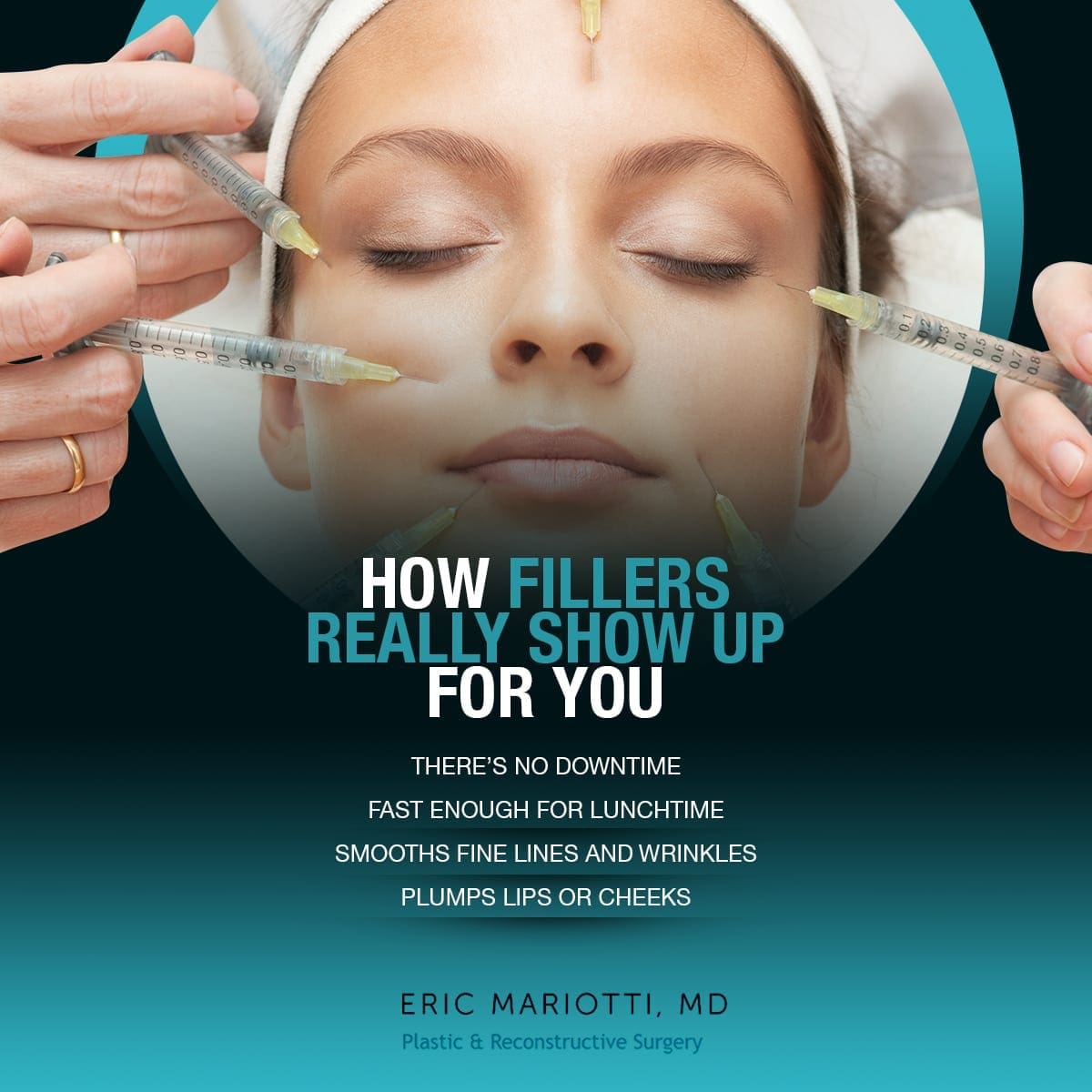 How Fillers Really Show Up For You [Infographic] img 1