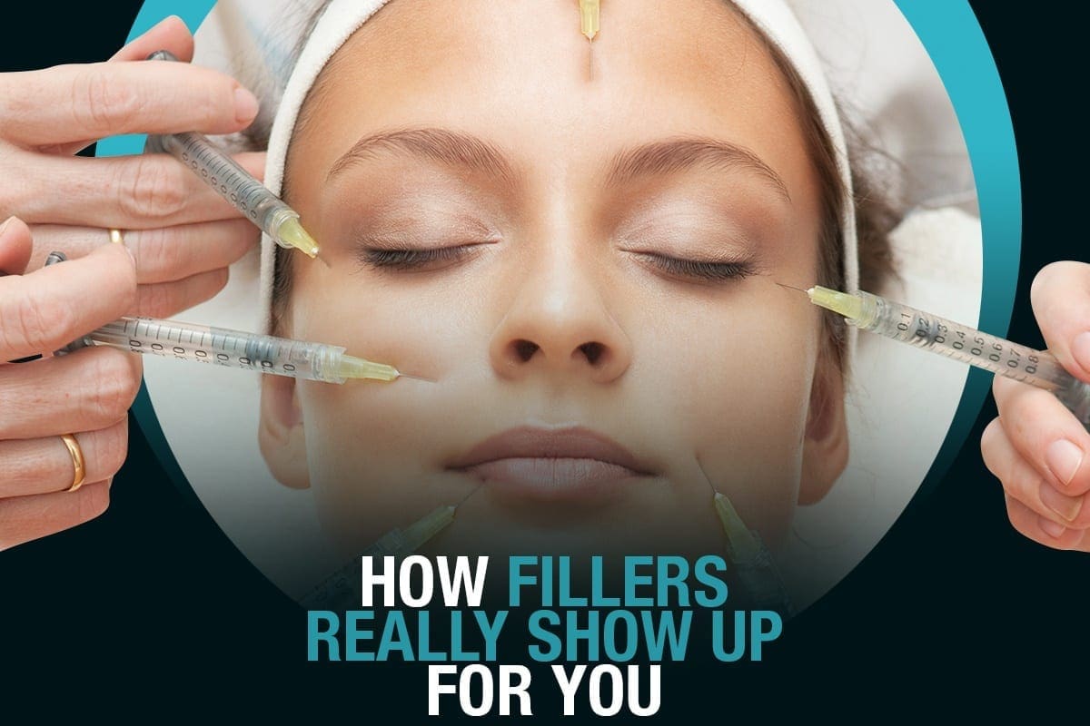 How Fillers Really Show Up For You [Infographic]