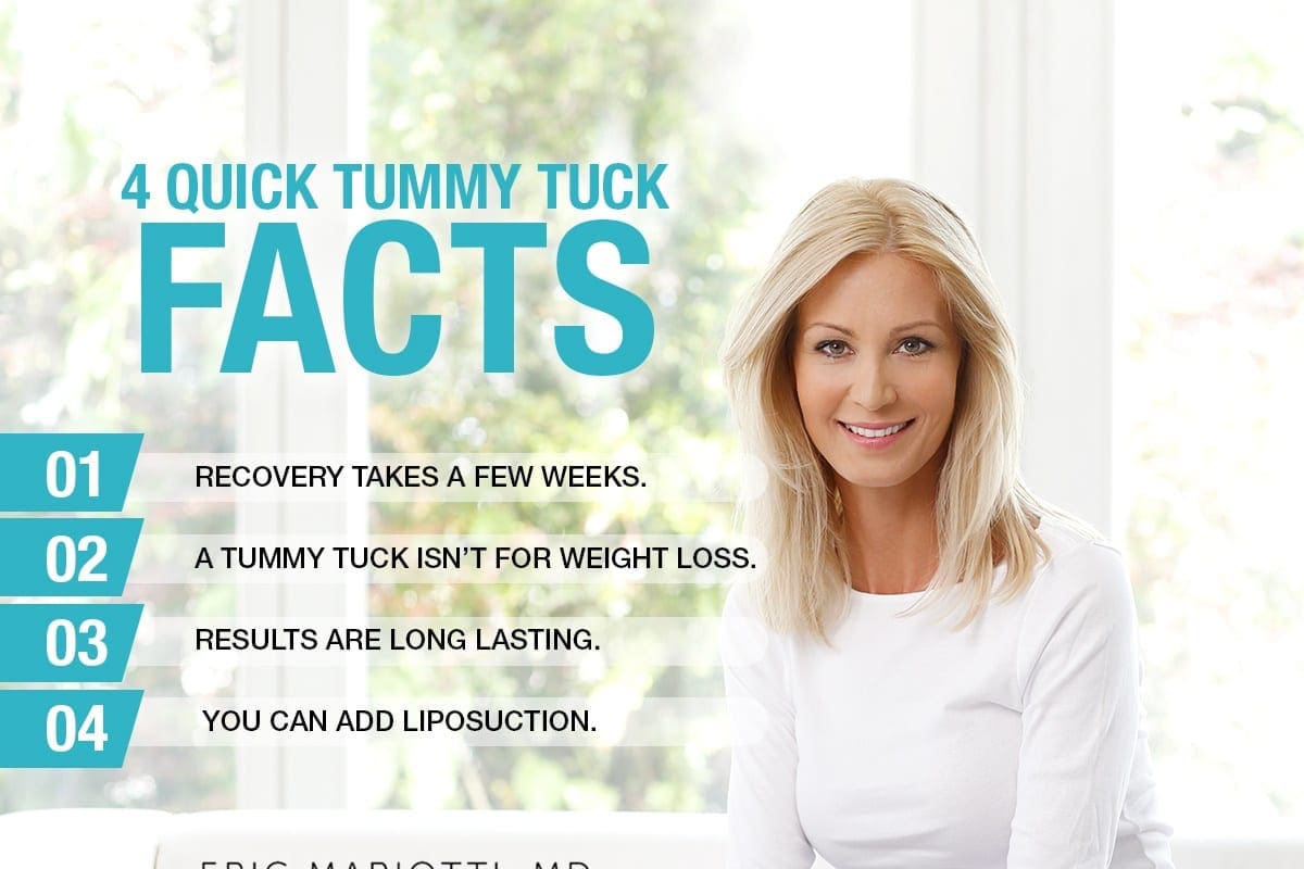 4 Quick Tummy Tuck Facts [Infographic]