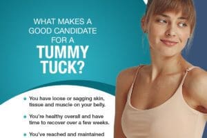 Tummy Tuck Infographic - May 22