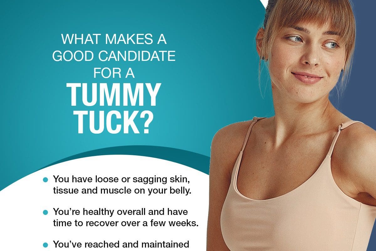 What Makes A Good Candidate For A Tummy Tuck? [Infographic]
