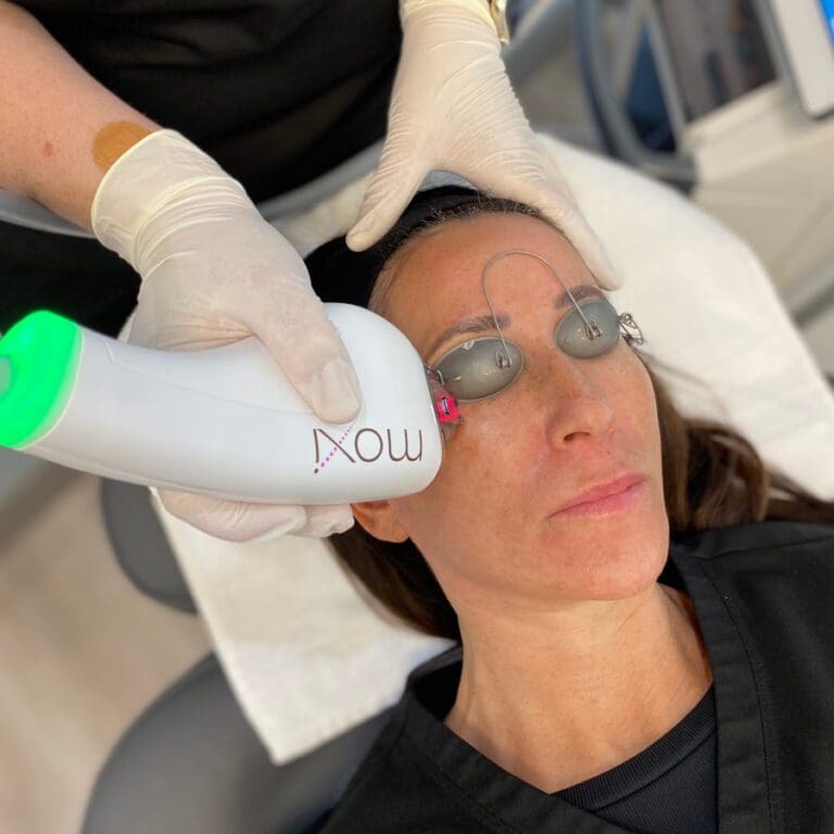 A woman receiving a MOXI laser facial treatment at a clinic, wearing protective eye shields while a technician uses the MOXI handheld device on her skin.