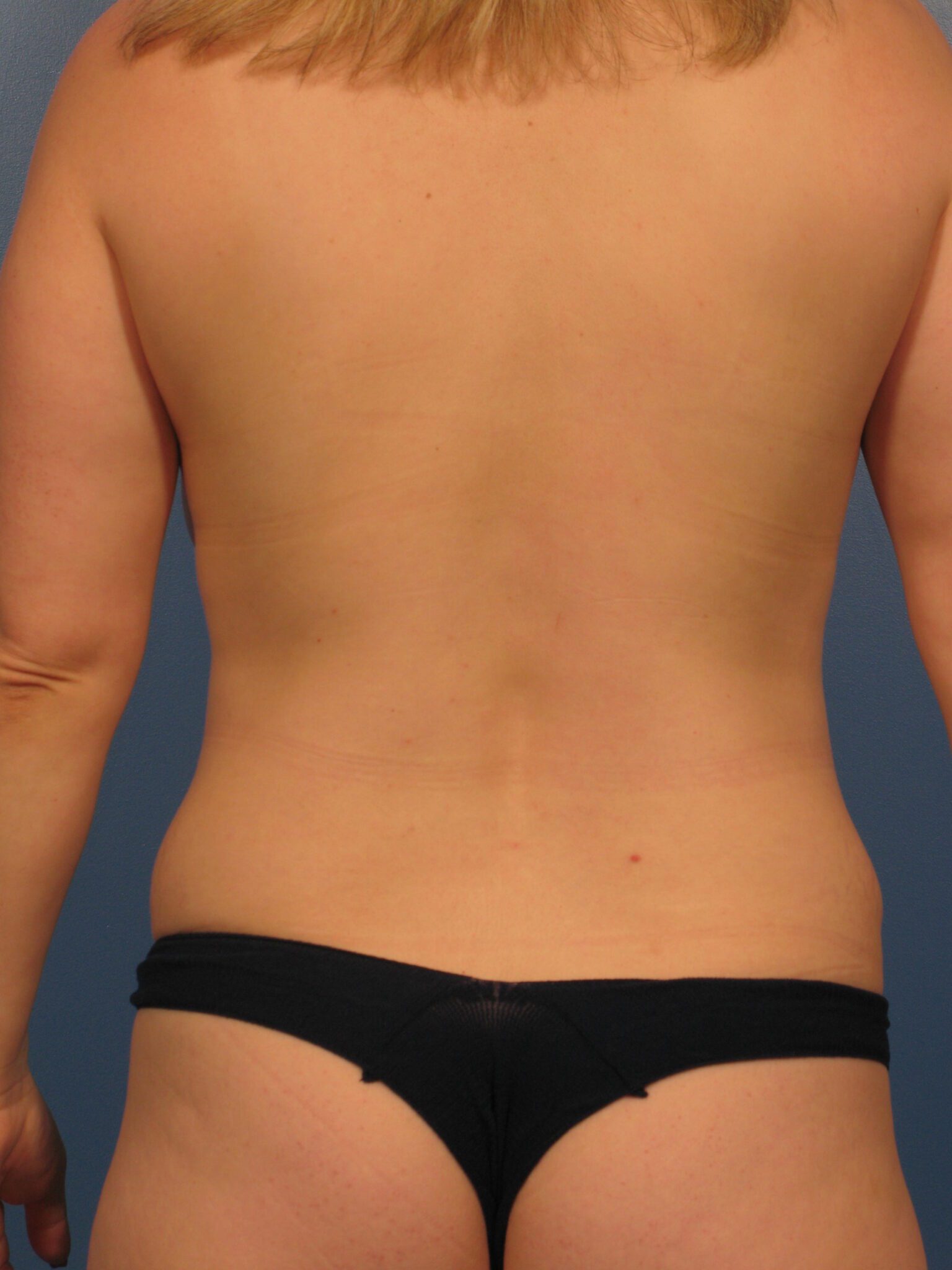 Case 1028 - Before
