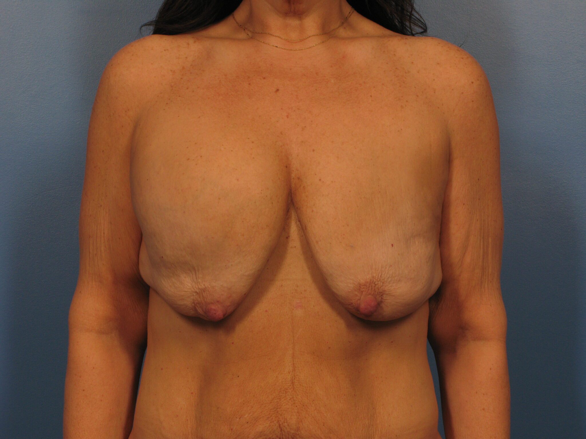 Case 1012 - Before