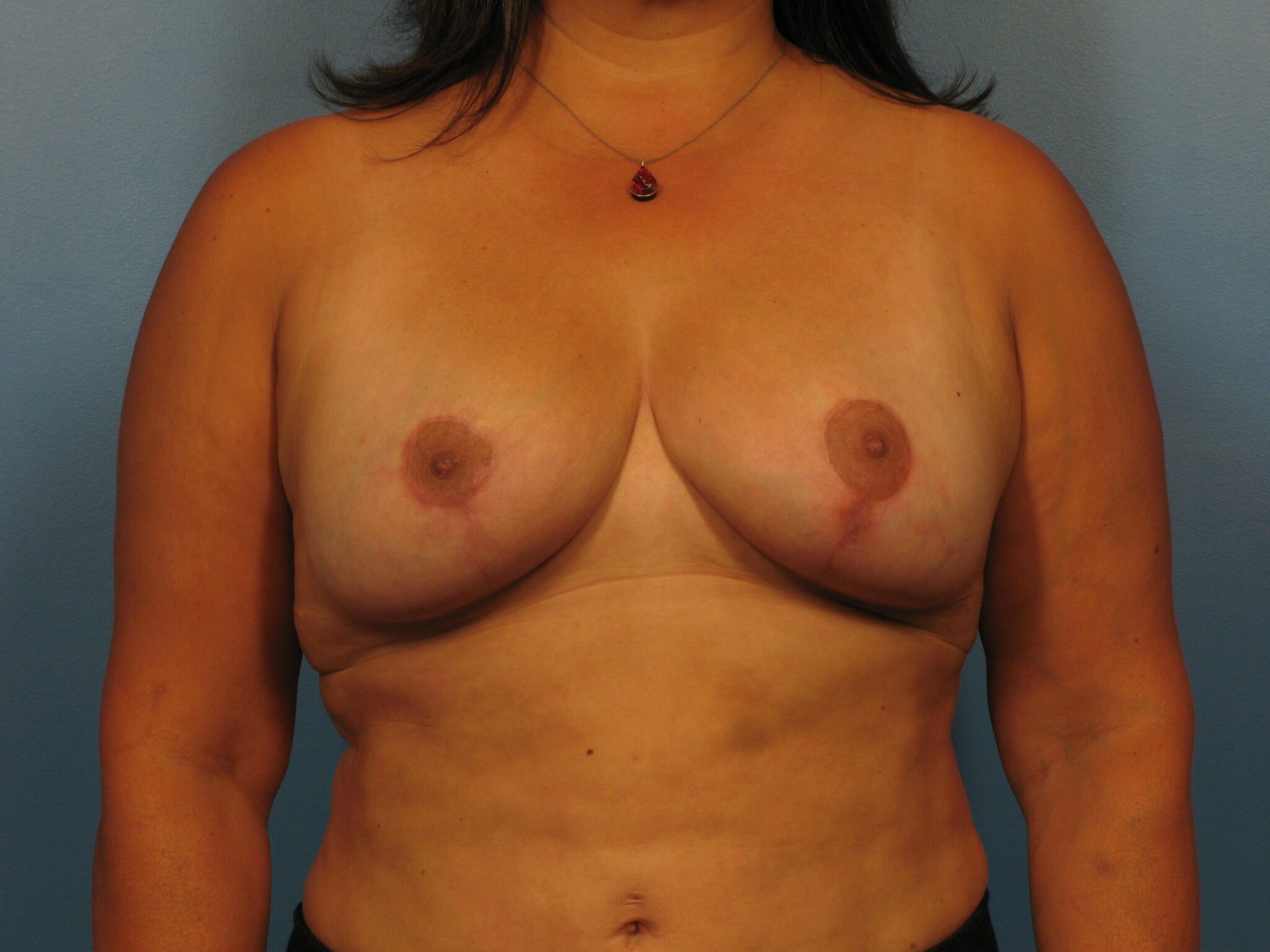 Case 1034 - After