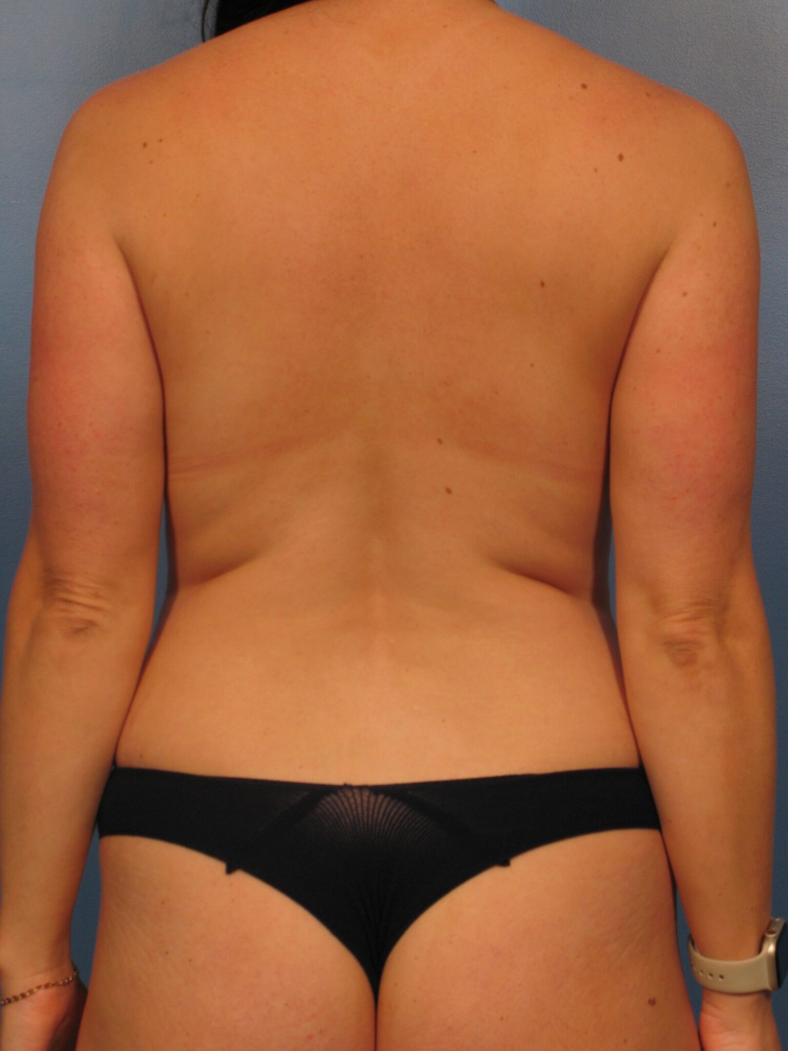 Case 1038 - Before