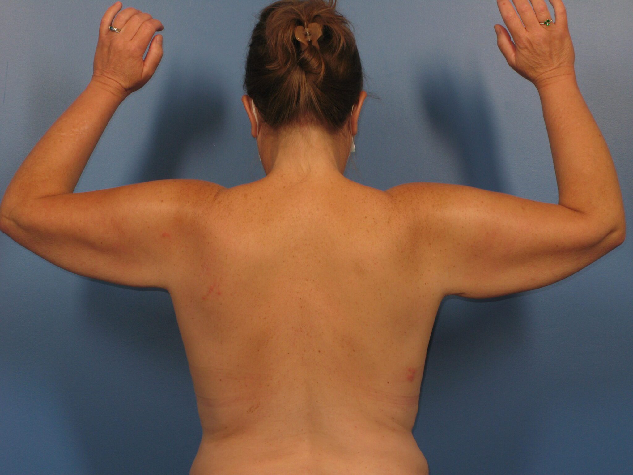 Case 1047 - Before