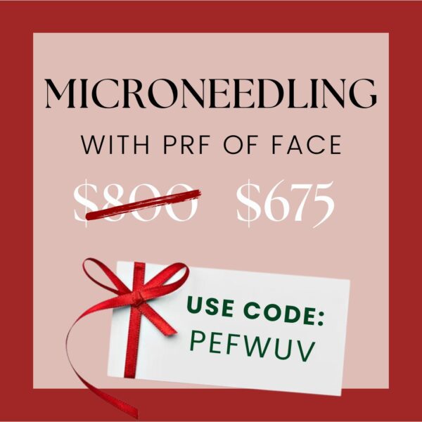 November 12 - Microneedling with PRF of Face - Image 2